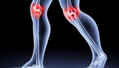 Prévention du développement de l'arthrite et de l'arthrose