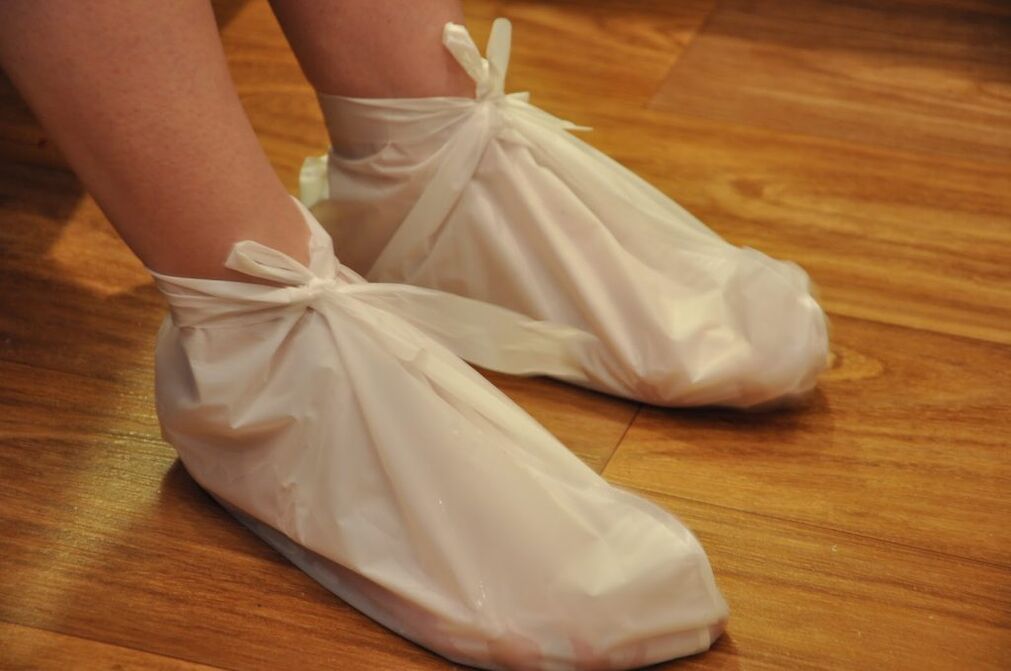 compresses pour l'arthrite de la cheville