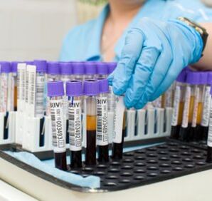 prise de sang pour diagnostiquer des douleurs articulaires