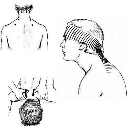 douleurs musculaires dans le cou et massage analgésique